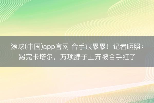 滚球(中国)app官网 合手痕累累！记者晒照：踢完卡塔尔，万项脖子上齐被合手红了
